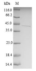 (Tris-Glycine gel) Discontinuous SDS-PAGE (reduced) with 5% enrichment gel and 15% separation gel.