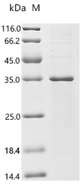 (Tris-Glycine gel) Discontinuous SDS-PAGE (reduced) with 5% enrichment gel and 15% separation gel.