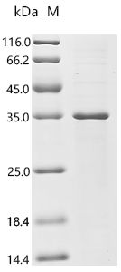 (Tris-Glycine gel) Discontinuous SDS-PAGE (reduced) with 5% enrichment gel and 15% separation gel.