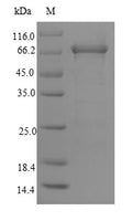 Recombinant Human DNA mismatch repair protein Msh6 (MSH6), partial – Figure 1 of 1