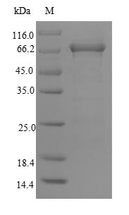 Recombinant Human DNA mismatch repair protein Msh6 (MSH6), partial – Figure 1 of 1