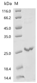 (Tris-Glycine gel) Discontinuous SDS-PAGE (reduced) with 5% enrichment gel and 15% separation gel.