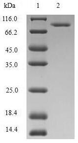 Recombinant Human Methylenetetrahydrofolate reductase (NADPH) (MTHFR) – Figure 1 of 1