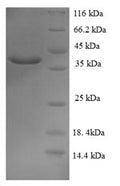 Recombinant Human Mucin-2 (MUC2), partial – Figure 1 of 1