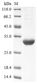 (Tris-Glycine gel) Discontinuous SDS-PAGE (reduced) with 5% enrichment gel and 15% separation gel.