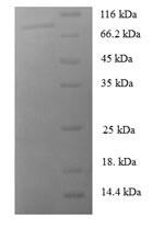 Recombinant Human Muscle, skeletal receptor tyrosine-protein kinase (MUSK), partial – Figure 1 of 1
