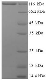 Recombinant Human Major vault protein (MVP) – Figure 1 of 1