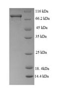Recombinant Mouse Myc proto-oncogene protein (Myc), partial – Figure 1 of 1