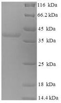Recombinant Human Myelin expression factor 2 (MYEF2), partial – Figure 1 of 1