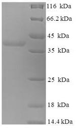 Recombinant Human Myelin expression factor 2 (MYEF2), partial – Figure 1 of 1