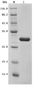 (Tris-Glycine gel) Discontinuous SDS-PAGE (reduced) with 5% enrichment gel and 15% separation gel.