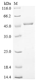 (Tris-Glycine gel) Discontinuous SDS-PAGE (reduced) with 5% enrichment gel and 15% separation gel.