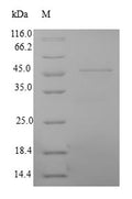 (Tris-Glycine gel) Discontinuous SDS-PAGE (reduced) with 5% enrichment gel and 15% separation gel.