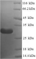 Recombinant Human Nanos homolog 2 (NANOS2) – Figure 1 of 1