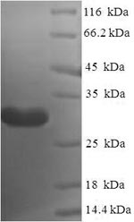 Recombinant Human Nanos homolog 2 (NANOS2) – Figure 1 of 1