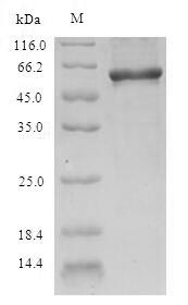 Recombinant Human Nicotinate phosphoribosyltransferase (NAPRT), partial – Figure 1 of 1