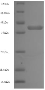 Recombinant Human Napsin-A (NAPSA) – Figure 1 of 1