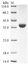 (Tris-Glycine gel) Discontinuous SDS-PAGE (reduced) with 5% enrichment gel and 15% separation gel.