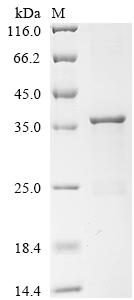 (Tris-Glycine gel) Discontinuous SDS-PAGE (reduced) with 5% enrichment gel and 15% separation gel.