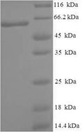Recombinant Human Cytoplasmic domain protein NCK2 (NCK2) – Figure 1 of 1