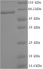 Recombinant Human Cytoplasmic domain protein NCK2 (NCK2) – Figure 1 of 1