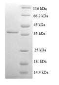 Recombinant Human NADH dehydrogenase [ubiquinone] 1 alpha subcomplex subunit 3 (NDUFA3) – Figure 1 of 1