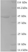 Recombinant Human NADH dehydrogenase [ubiquinone] 1 alpha subcomplex subunit 6 (NDUFA6) – Figure 1 of 1