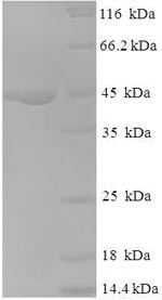 Recombinant Human NADH dehydrogenase [ubiquinone] 1 alpha subcomplex subunit 6 (NDUFA6) – Figure 1 of 1