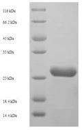 Recombinant Human NADH dehydrogenase [ubiquinone] 1 beta subcomplex subunit 5, mitochondrial (NDUFB5), partial – Figure 1 of 