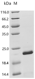 (Tris-Glycine gel) Discontinuous SDS-PAGE (reduced) with 5% enrichment gel and 15% separation gel.