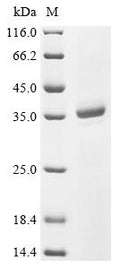 (Tris-Glycine gel) Discontinuous SDS-PAGE (reduced) with 5% enrichment gel and 15% separation gel.