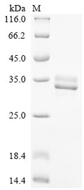 (Tris-Glycine gel) Discontinuous SDS-PAGE (reduced) with 5% enrichment gel and 15% separation gel.