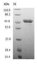 (Tris-Glycine gel) Discontinuous SDS-PAGE (reduced) with 5% enrichment gel and 15% separation gel.