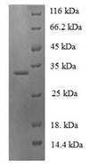 Recombinant Human Neuroglobin (NGB) – Figure 1 of 1