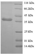 Recombinant Human Protein BEX3 (NGFRAP1) – Figure 1 of 1