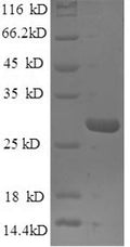 Recombinant Mouse Nidogen-1 (Nid1), partial – Figure 1 of 1