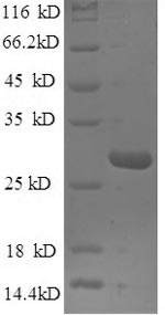 Recombinant Mouse Nidogen-1 (Nid1), partial – Figure 1 of 1