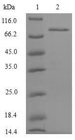 (Tris-Glycine gel) Discontinuous SDS-PAGE (reduced) with 5% enrichment gel and 15% separation gel.