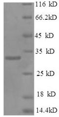 Recombinant Human NK-tumor recognition protein (NKTR), partial – Figure 1 of 1
