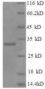 Recombinant Human NK-tumor recognition protein (NKTR), partial – Figure 1 of 1