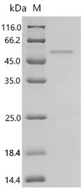 Recombinant Human Homeobox protein Nkx-2.1 (NKX2-1) – Figure 1 of 1