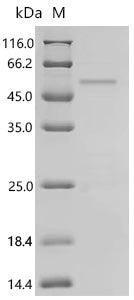 Recombinant Human Homeobox protein Nkx-2.1 (NKX2-1) – Figure 1 of 1