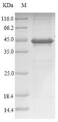 (Tris-Glycine gel) Discontinuous SDS-PAGE (reduced) with 5% enrichment gel and 15% separation gel.