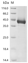 (Tris-Glycine gel) Discontinuous SDS-PAGE (reduced) with 5% enrichment gel and 15% separation gel.
