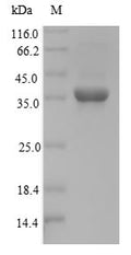 (Tris-Glycine gel) Discontinuous SDS-PAGE (reduced) with 5% enrichment gel and 15% separation gel.