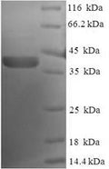 Recombinant Human Nucleolar protein 3 (NOL3) – Figure 1 of 1