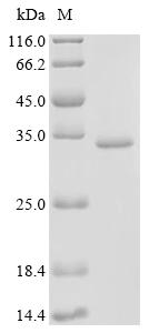 (Tris-Glycine gel) Discontinuous SDS-PAGE (reduced) with 5% enrichment gel and 15% separation gel.