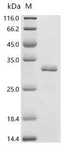 (Tris-Glycine gel) Discontinuous SDS-PAGE (reduced) with 5% enrichment gel and 15% separation gel.