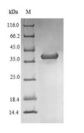 (Tris-Glycine gel) Discontinuous SDS-PAGE (reduced) with 5% enrichment gel and 15% separation gel.