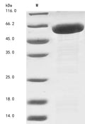 (Tris-Glycine gel) Discontinuous SDS-PAGE (reduced) with 5% enrichment gel and 15% separation gel.